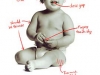 baby_getscosemeticsurgery